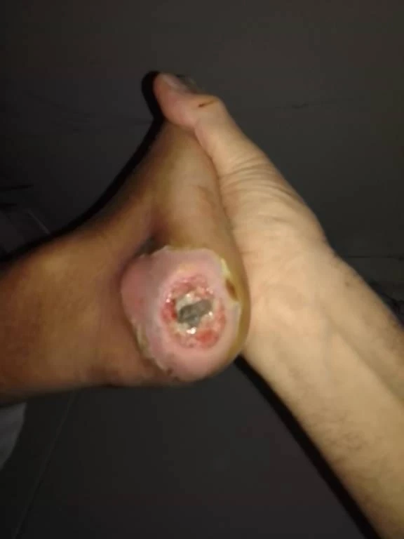 Cárcel San Felipe. Imágenes no aptas para personas sensibles e impresionables. 