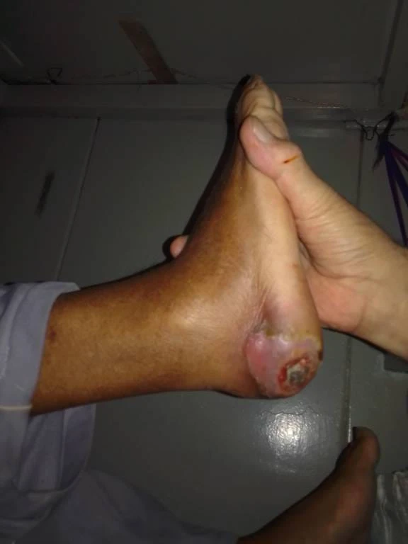 Cárcel San Felipe. Imágenes no aptas para personas sensibles e impresionables. 