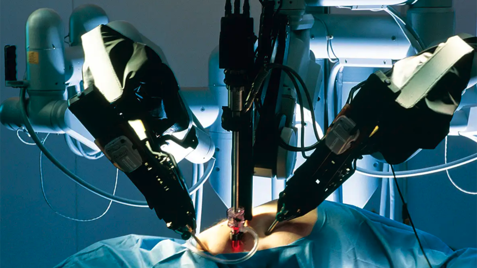 IA y Robótica en cirugía: un futuro preciso y seguro