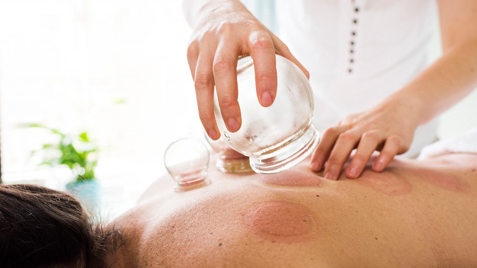 Terapias naturales y medicina alternativa: un enfoque integral para la salud