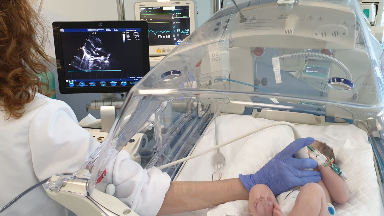 Milei desarticula el equipo que coordina el Programa Nacional de Cardiopatías Congénitas