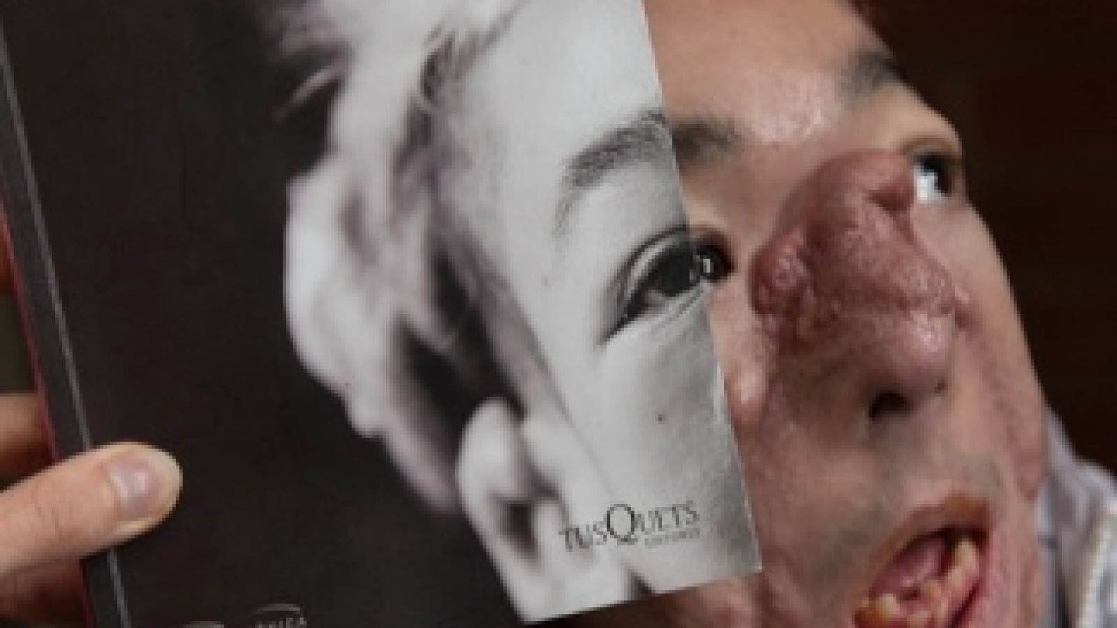 Matías Fernández Burzaco: «Ser deforme no es un insulto, es muy loco, divertido»