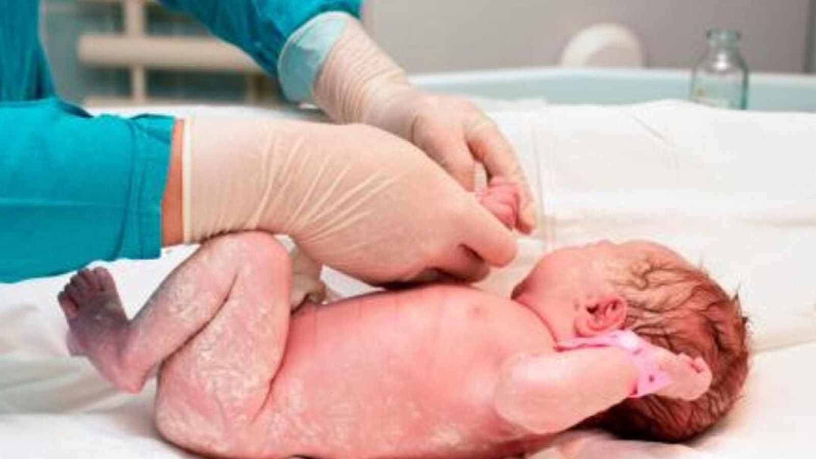 Proponen programa para detectar trastornos visuales desde el nacimiento