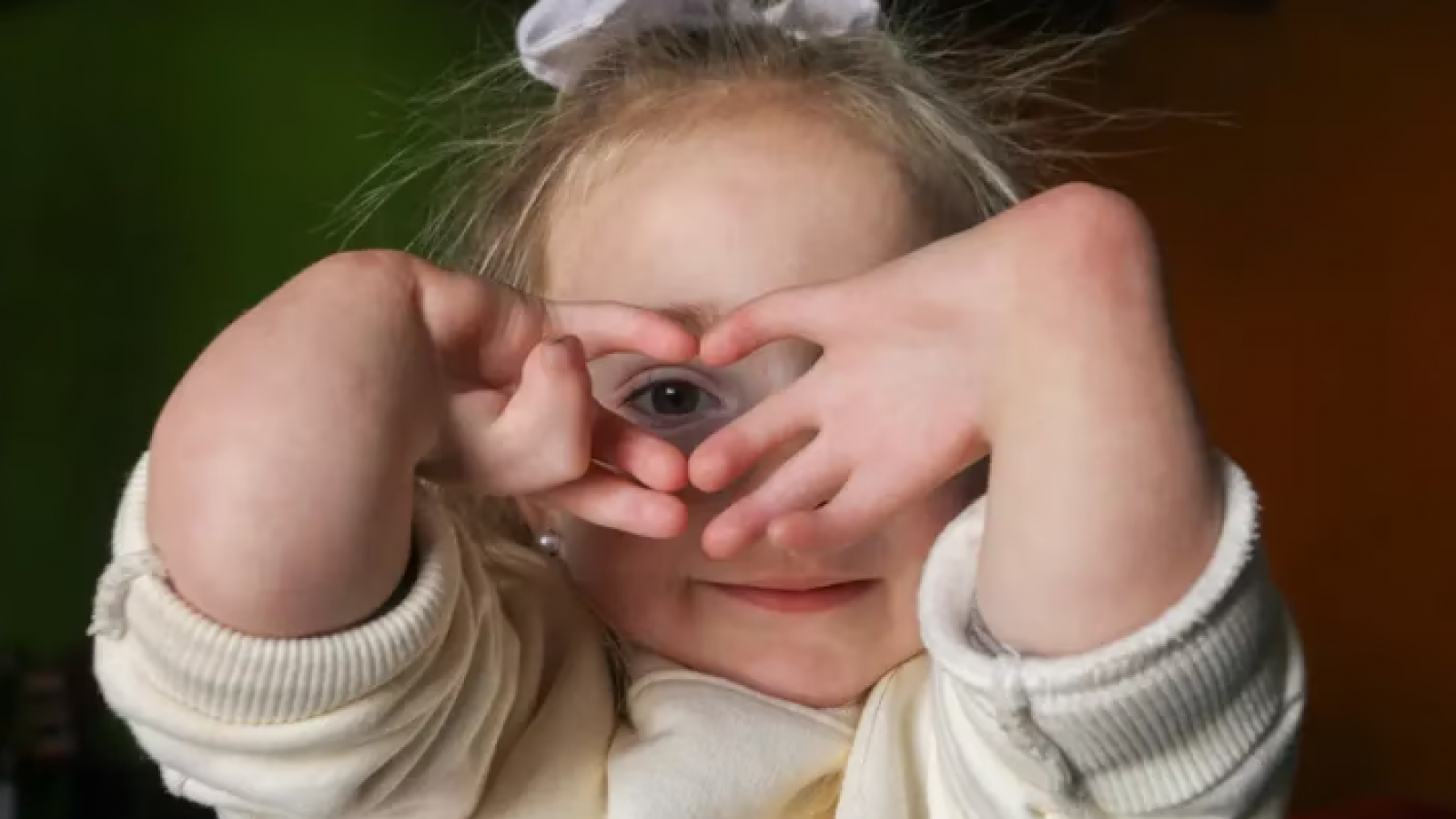 A un día de su operación Juanita sigue recibiendo solidaridad