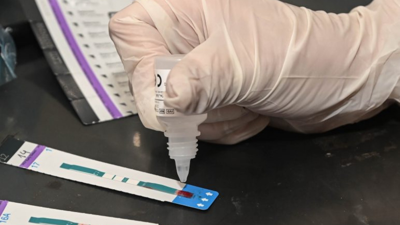 Godoy Cruz: Operativo de testeos VIH en América y Chuquisaca