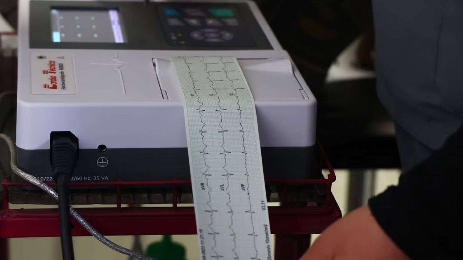 Todos los centros de salud de Maipú cuentan con electrocardiógrafos